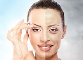 L型假體隆鼻持久度有多久？探討假體隆鼻效果持續(xù)時(shí)間