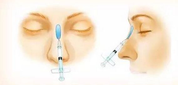 美白祛斑的方法有哪些？4種醫(yī)美美肌方案推薦