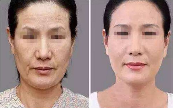 如何讓幼態(tài)臉變得緊致有型？塑造迷人圓潤臉型攻略揭秘！