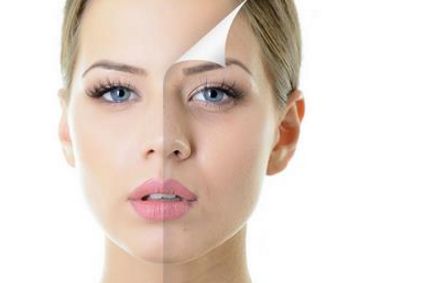 光子嫩膚安全性揭秘：效果持久且無(wú)副作用！