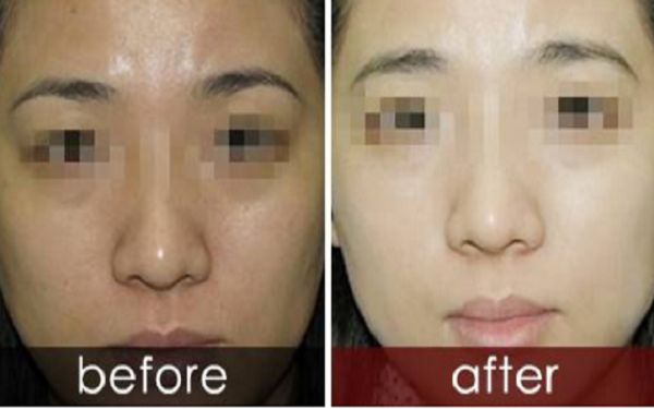 曬黑后如何迅速變白？曬黑美白需要持續(xù)護(hù)理多久結(jié)果可見(jiàn)？了解曬后護(hù)膚科普！