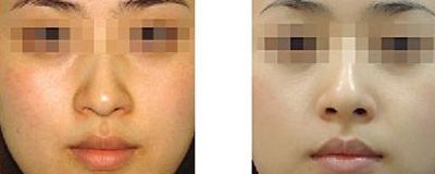 潤(rùn)百顏：性價(jià)高國(guó)產(chǎn)玻尿酸測(cè)評(píng)，你值得擁有！