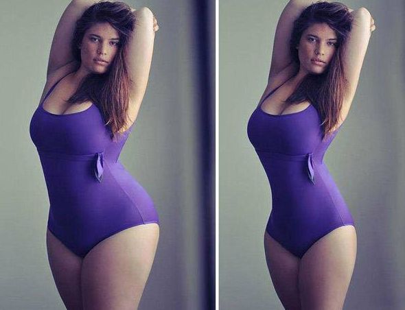 自體軟骨隆鼻效果能維持多長時間？及材料品質(zhì)的影響