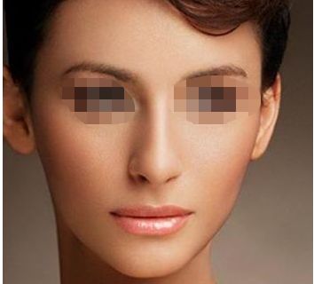 幼態(tài)臉緊致效果揭秘！填充劑真的消腫及維持時長有保障嗎？整容前必讀！