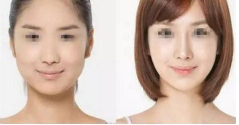 ?？靠噹Т蛟祆n麗顏值  面部提升不再繁復(fù)