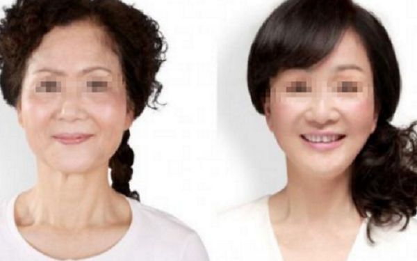 處女膜修補手術(shù)是否需要麻醉？