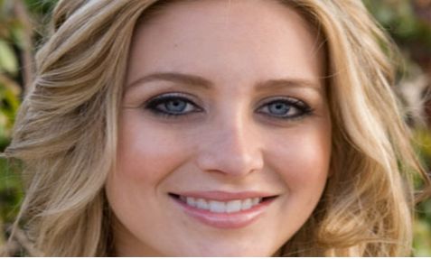 上眼瞼下垂手術(shù)的安全性調(diào)查