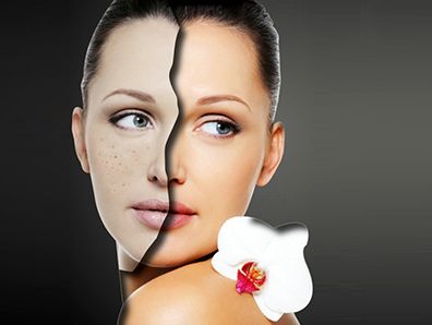 去眼袋手術(shù)維持時(shí)間和溶脂技術(shù)手術(shù)原理解析