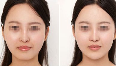 顴骨高如何改善臉型？假發(fā)光、真為你講解不同方法！