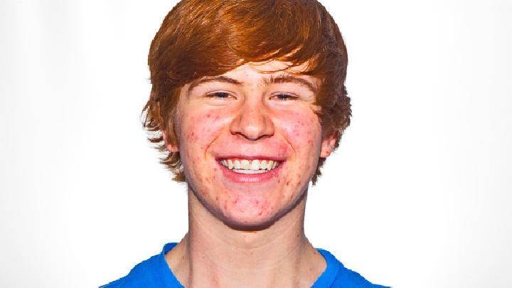 快速有效祛痘的方法分享：如何迅速有效去除痘痘