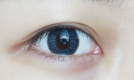 淮南市醫(yī)院有做雙眼皮手術(shù)嗎？手術(shù)技術(shù)如何？價(jià)格如何？實(shí)例解析給您參考