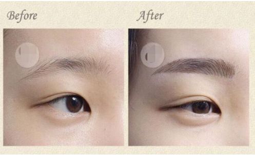 成都華西口腔種植牙費(fèi)用一覽表出爐！想了解非常受歡迎的五位醫(yī)生？