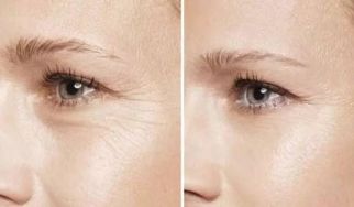 杭州哪家激光祛斑醫(yī)院靠譜？網(wǎng)友強推前五實力醫(yī)院