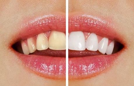 榆林市第一醫(yī)院最牛眼科專家曝光！秒懂近視眼手術真相