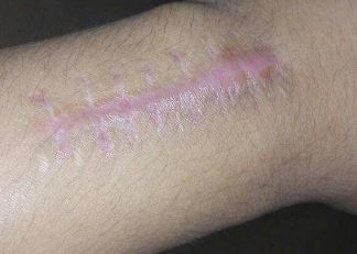 西安鼻子整形專家推薦：醫(yī)術(shù)高明的頂級(jí)醫(yī)生名錄