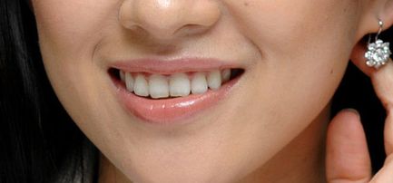 探尋西安藝星宋蔚雙眼皮技術(shù)，深度解析醫(yī)生實力與經(jīng)典案例分享