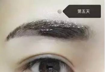 南昌美伊爾劉立軍醫(yī)生膨體隆鼻整形費(fèi)用？手術(shù)效果如何？帶您看醫(yī)生案例