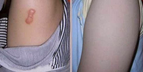 天津河?xùn)|美萊醫(yī)學(xué)醫(yī)院受推崇的全雙醫(yī)生吸脂術(shù)是否靠譜？