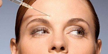 2023年協(xié)和醫(yī)院：王陽臉部脂肪充填成功案例發(fā)布