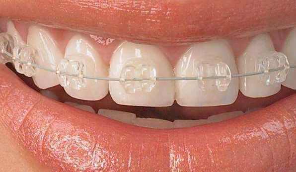 商洛中醫(yī)醫(yī)院燒傷整形科：口碑佳，價格公道，性價比高