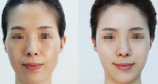 南寧亞太整形醫(yī)院：專家云集，口碑相傳