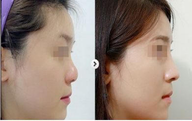 2024年度中國整容醫(yī)院匯總：最佳五家醫(yī)療機構(gòu)揭曉