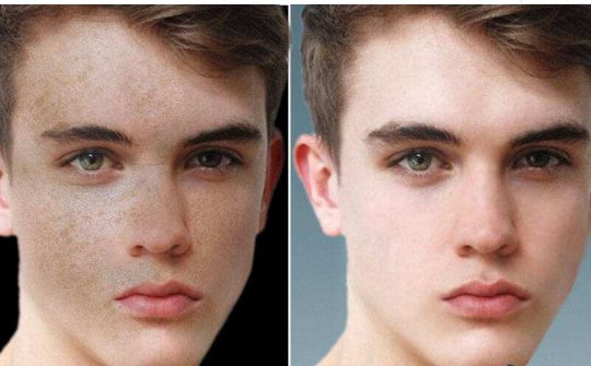 2024中國(guó)假體隆胸權(quán)威醫(yī)院指南：上海、北京、廣州、武漢