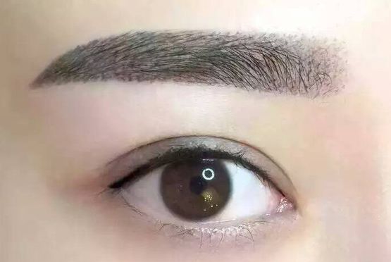 喬軍醫(yī)生眼部整形手術(shù)能力如何？詳解醫(yī)生經(jīng)歷與成功案例