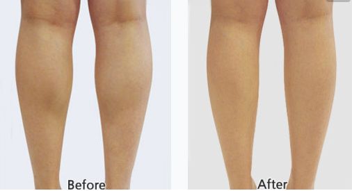 射頻緊膚整形醫(yī)院排行榜，專家推薦的三家一流醫(yī)院震撼上榜