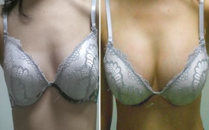 2023年推薦的專業(yè)北京地區(qū)鼻部修復醫(yī)療中心排行榜