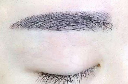 深圳治療疤痕的醫(yī)院推薦！實時更新名單發(fā)布！