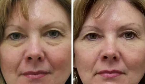 廣州植發(fā)領(lǐng)先機(jī)構(gòu)推薦：連鎖醫(yī)院專業(yè)信譽(yù)備受肯定！