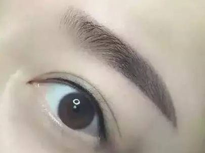 周兆平醫(yī)生雙眼皮手術需等候排隊嗎？醫(yī)生經(jīng)歷&案例顯示，2023瞳瞳提升策略！