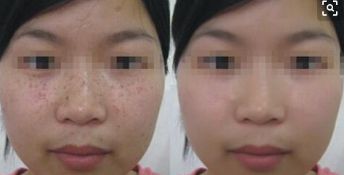 駐馬店中心醫(yī)院醫(yī)美科的專家醫(yī)生及眼綜合整形案例分析