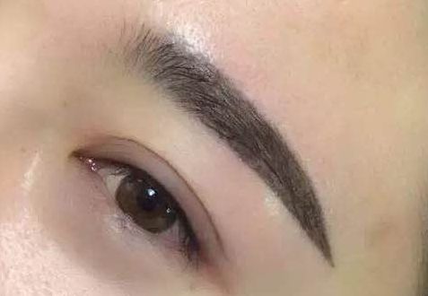 華西卿勇隆鼻技術(shù)體驗(yàn)分享：醫(yī)生實(shí)力評(píng)述及效果圖展示！