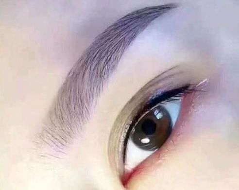 孟慶鵬最新鼻部整形手術(shù)效果怎么樣？贊譽(yù)無數(shù)的醫(yī)生評價+手術(shù)案例分享！鄭州uu們必看~