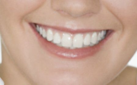 貴陽(yáng)美貝爾錢(qián)剛技術(shù)的用戶(hù)評(píng)價(jià)和玻尿酸隆鼻案例分享