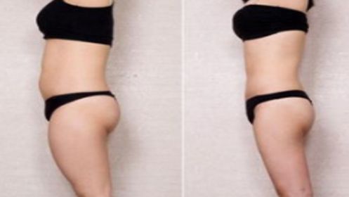 找專業(yè)的雙眼皮醫(yī)院推薦！以下幾家實(shí)力醫(yī)療機(jī)構(gòu)值得考慮