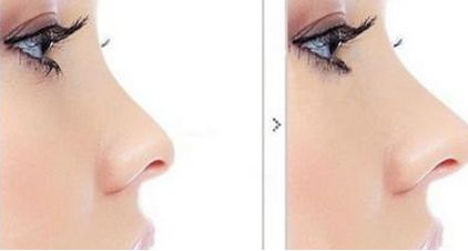 上海眼部整形最佳醫(yī)院排行榜公布！驚喜TOP10等你挖掘