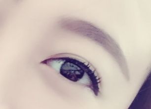 劉春軍豐胸手術(shù)后效果如何？費(fèi)用怎么樣？醫(yī)生概況+隆胸真實(shí)案例圖為參考