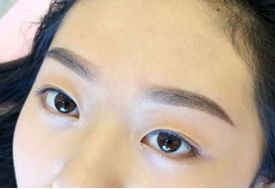 最佳選擇！濟(jì)南眼部整形資深專家Top10名單揭曉