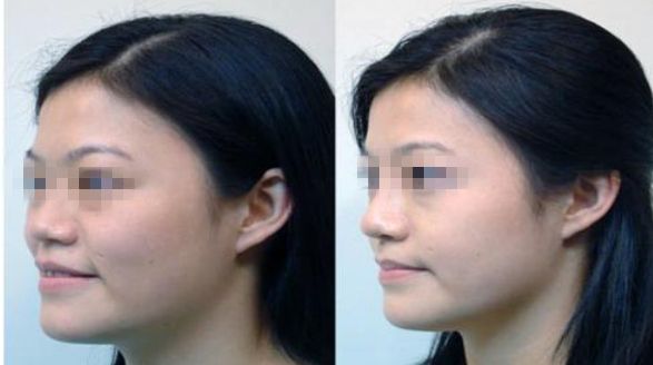 濟(jì)南市哪家整形醫(yī)院正規(guī)專業(yè)？推薦可靠的名單