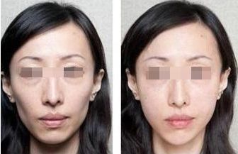 北京頂尖整形醫(yī)院排行榜公布，這三家實力過硬