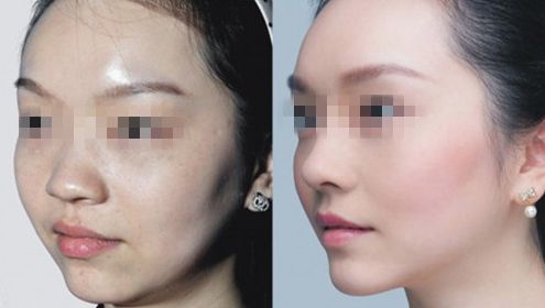 樂山市哪家整形美容醫(yī)院好評(píng)如潮