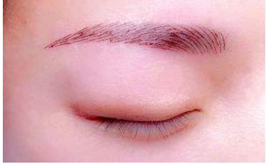 深圳醫(yī)生劉冰的鼻子整形效果如何？專業(yè)實(shí)力及成功案例發(fā)布