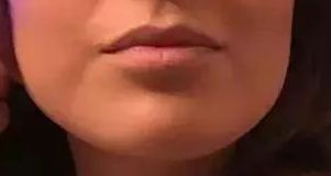 2023北京八大處醫(yī)院雙眼皮手術(shù)醫(yī)生榜單揭曉，楊明勇、王佳琦、靳小雷等醫(yī)師備受好評！