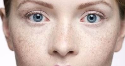 成都江濤醫(yī)生專業(yè)提供雙眼皮修復(fù)服務(wù)，助您重拾雙眼魅力