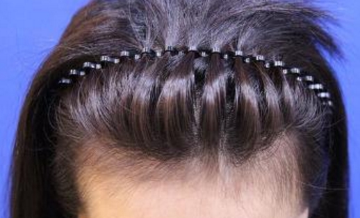 洛陽做肋骨鼻哪里好？整形醫(yī)院效果如何？