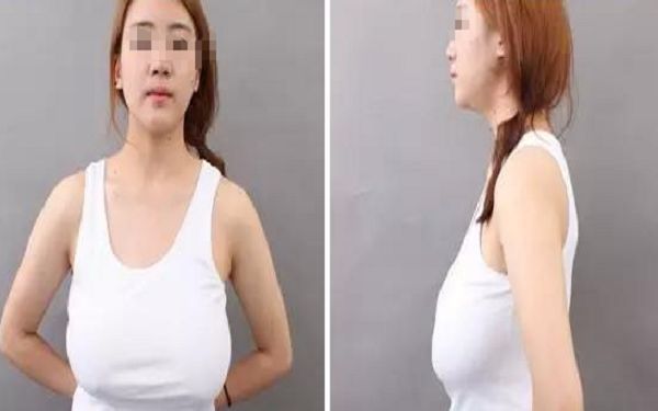 山西大同整容醫(yī)院排名前三