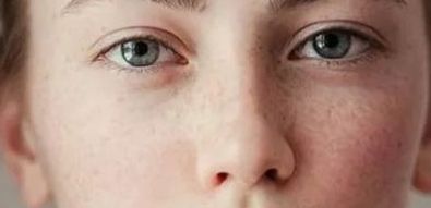 深圳鵬愛整形術(shù)后效果如何？胸部隆胸手術(shù)案例分享